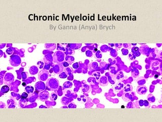 Chronic Myeloid Leukemia
By Ganna (Anya) Brych
 