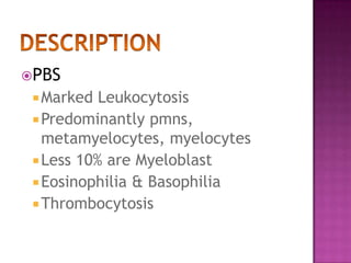 PBSMarked LeukocytosisPredominantly pmns, metamyelocytes, myelocytesLess 10% are MyeloblastEosinophilia & BasophiliaThrombocytosisDESCRIPTION