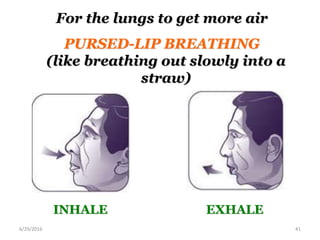 For the lungs to get more air
PURSED-LIP BREATHING
(like breathing out slowly into a
straw)
6/29/2016 41
INHALE EXHALE
 