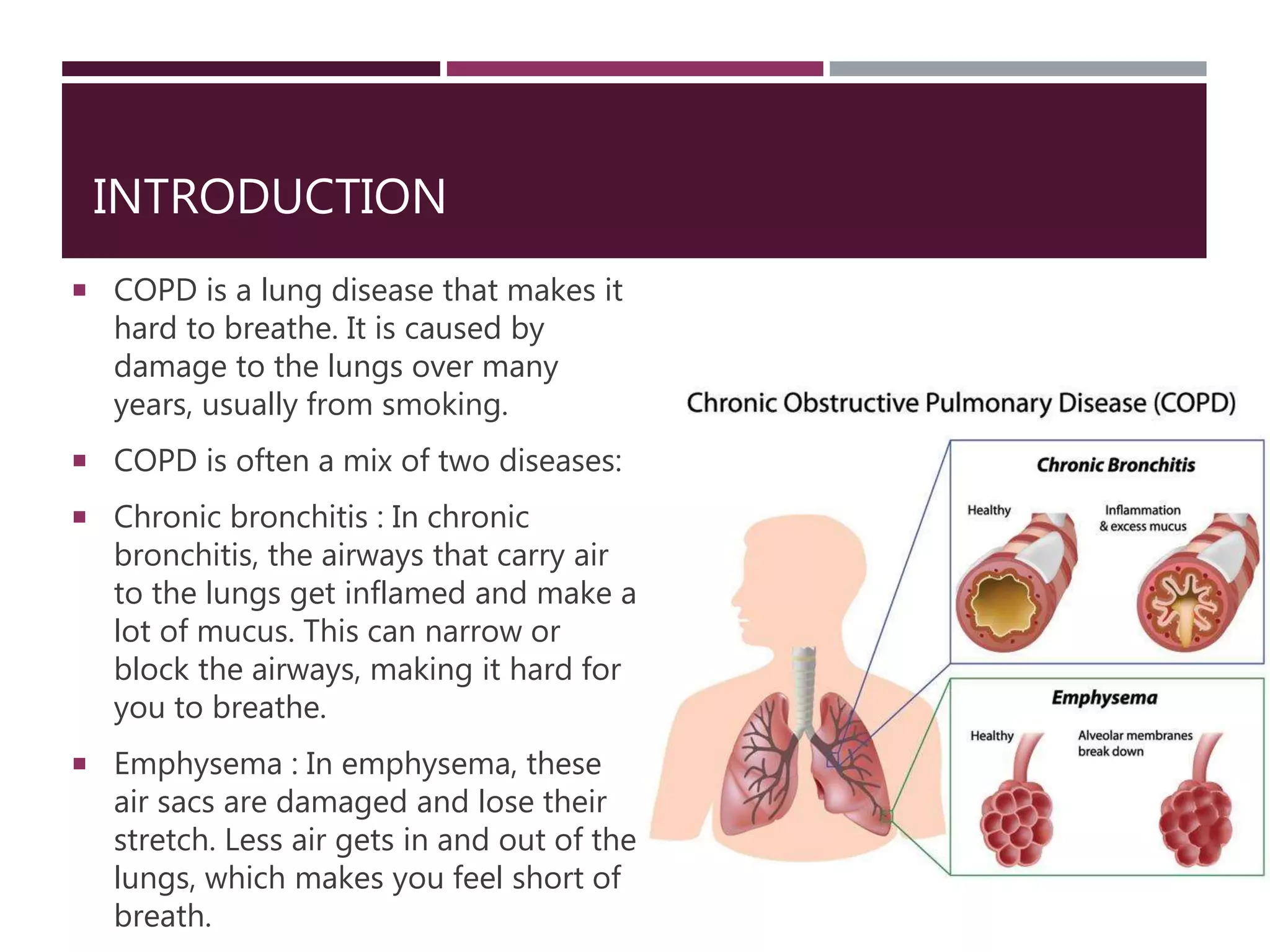 Chronic obstructive pulmonary disease (copd) | PPTX