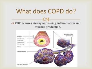 What does COPD do?
                      inflammation and
 COPD causes airway narrowing,
             mucous production.




                                          4
 