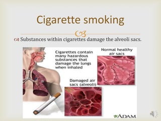 Cigarette smoking
                         damage the alveoli sacs.
 Substances within cigarettes




                                                     9
 