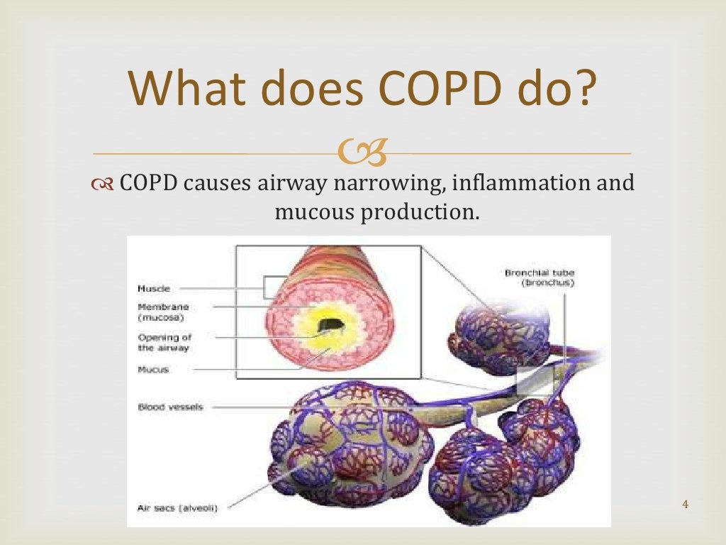 case study of copd ppt