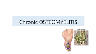 Chronic OSTEOMYELITIS
 
