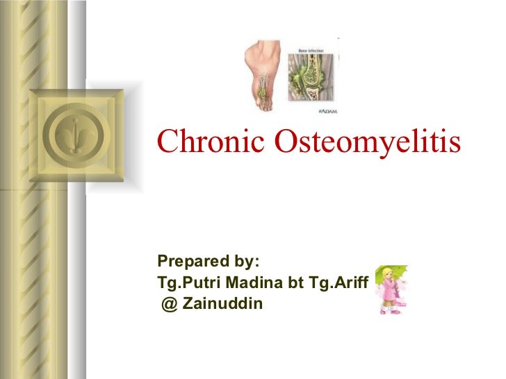 Chronic osteomyelitis