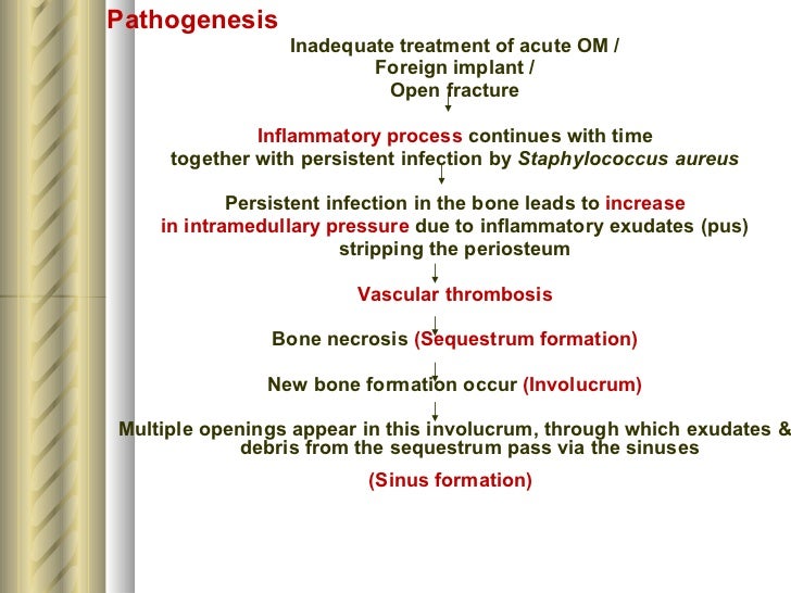 Chronic osteomyelitis sinus pain diagram 