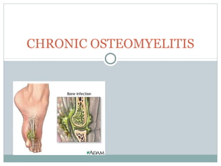 CHRONIC OSTEOMYELITIS
 