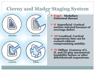 Cierny and Mader Staging System
MedullaryEndosteal
disease
 TypeI Medullary
Endosteal disease
 II Superficial Cortical
surface infected because of
coverage defect
 III Localized Cortical
sequestrum that can be
excised without
compromising stability
 IV Diffuse Features of I,
II, and III plus mechanical
instability before or after
débridementl sequestrum
 