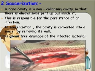 2.Saucerization:-
 A bone cavity is a non – collapsing cavity so that
there is always some pent up pus inside it.
 This is responsible for the persistence of an
infection.
 In saucerization , the cavity is converted into a
saucer by removing its wall.
This allows free drainage of the infected material.
 