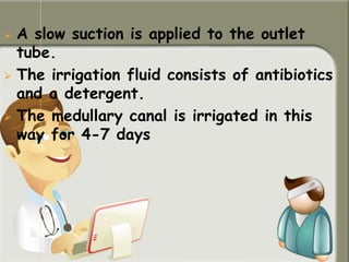  A slow suction is applied to the outlet
tube.
 The irrigation fluid consists of antibiotics
and a detergent.
 The medullary canal is irrigated in this
way for 4-7 days
 