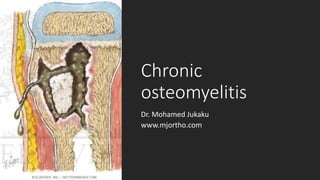 Chronic
osteomyelitis
Dr. Mohamed Jukaku
www.mjortho.com
 
