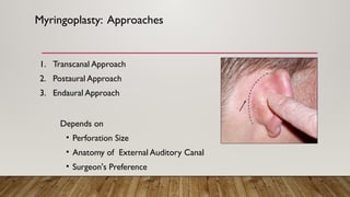Chronic otitis media- Mucosal chronic chronic media idk | PPTX
