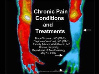 Chronic Pain  Conditions  and  Treatments Bruce Vrooman, MD (CA-2) Stephanie VanKraaij, MD (CA-1) Faculty Advisor: Abdel Mehio, MD Boston University  Department of Anesthesiology May 11, 2006 http://www.thermogramcenter.com/Images_files/RSD%20arms.jpg 