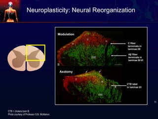 Neuroplasticity: Neural Reorganization
Modulation
Axotomy
CTB = cholera toxin B.
Photo courtesy of Professor S.B. McMahon.
11
C fiber
terminals in
laminae I/II
Aβ fiber
terminals in
laminae III-VI
 