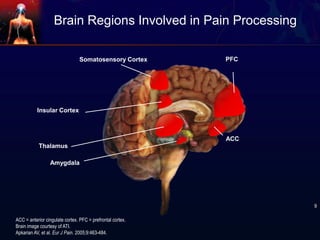 ACC = anterior cingulate cortex. PFC = prefrontal cortex.
Brain image courtesy of ATI.
Apkarian AV, et al. Eur J Pain. 2005;9:463-484.
PFCSomatosensory Cortex
Thalamus
ACC
Insular Cortex
Brain Regions Involved in Pain Processing
Amygdala
9
 