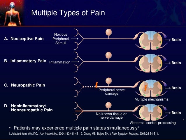 neuropathic pain for paracetamol RHEUMATIC Nociceptive ELIM Pain CENTRE neuropathic pain for paracetamol RHEUMATIC Nociceptive ELIM Pain CENTRE