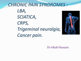 CHRONIC PAIN SYNDROMES :
LBA,
SCIATICA,
CRPS,
Trigeminal neuralgia,
Cancer pain.
Dr Aftab Hussain
 