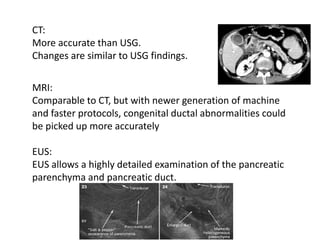 CT:
More accurate than USG.
Changes are similar to USG findings.
MRI:
Comparable to CT, but with newer generation of machine
and faster protocols, congenital ductal abnormalities could
be picked up more accurately
EUS:
EUS allows a highly detailed examination of the pancreatic
parenchyma and pancreatic duct.
 