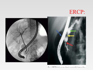 ERCP:
•
 