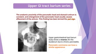 The anatomic proximity of the pancreatic head and stomach antrum is
constant, and enlargement of the pancreatic head usually causes
effacement of the antrum. This finding has been termed the pad sign.
Upper gastrointestinal tract barium
study shows a reverse 3 in the
duodenum due to chronic pancreatitis.
Pancreatic carcinoma can have a
similar appearance
Upper GI tract barium series
 
