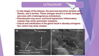 • In late stages of the disease, the pancreas becomes atrophic and
fibrotic, and it shrinks. These changes result in a small, echogenic
pancreas with a heterogeneous echotexture.
• Pseudocysts may occur, and focal hypoechoic inflammatory
masses may mimic pancreatic neoplasia.
• Calculi and calcification in the gland result in densely echogenic
foci, which may show shadow
ULTRASOUND
 