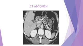 CT ABDOMEN
 
