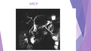 MRCP
 