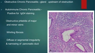  Obstructive Chronic Pancreatitis –gland upstream of obstruction
 Autoimmune Chronic Pancreatitis -
Positive for IgG4 staining
Obstructive phlebitis of major
and minor veins
Whirling fibrosis
Diffuse or segmental irregularity
& narrowing of pancreatic duct
 