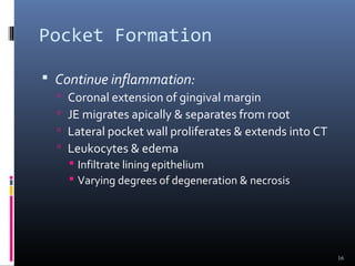 Pocket Formation
 Continue inflammation:
 Coronal extension of gingival margin
 JE migrates apically & separates from root
 Lateral pocket wall proliferates & extends into CT
 Leukocytes & edema
 Infiltrate lining epithelium
 Varying degrees of degeneration & necrosis
16
 