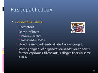 Histopathology
 Connective Tissue:
 Edematous
 Dense infiltrate:
 Plasma cells (80%)
 Lymphocytes, PMNs
 Blood vessels proliferate, dilate & are engorged.
 Varying degrees of degeneration in addition to newly
formed capillaries, fibroblasts, collagen fibers in some
areas.
20
 