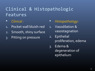 Clinical & Histopathologic
Features
 Clinical :
1. Pocket wall bluish-red
2. Smooth, shiny surface
3. Pitting on pressure
 Histopathology:
1. Vasodilation &
vasostagnation
2. Epithelial
proliferation, edema
3. Edema &
degeneration of
epithelium
22
 
