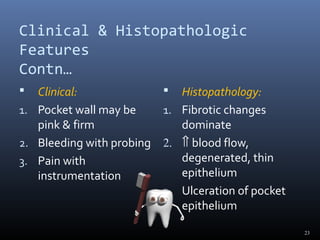 Clinical & Histopathologic
Features
Contn…
 Clinical:
1. Pocket wall may be
pink & firm
2. Bleeding with probing
3. Pain with
instrumentation
 Histopathology:
1. Fibrotic changes
dominate
2. ⇑ blood flow,
degenerated, thin
epithelium
3. Ulceration of pocket
epithelium
23
 