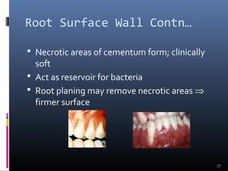 Root Surface Wall Contn…
 Necrotic areas of cementum form; clinically
soft
 Act as reservoir for bacteria
 Root planing may remove necrotic areas ⇒
firmer surface
27
 