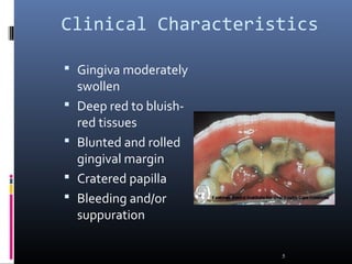 Clinical Characteristics
 Gingiva moderately
swollen
 Deep red to bluish-
red tissues
 Blunted and rolled
gingival margin
 Cratered papilla
 Bleeding and/or
suppuration
5
 