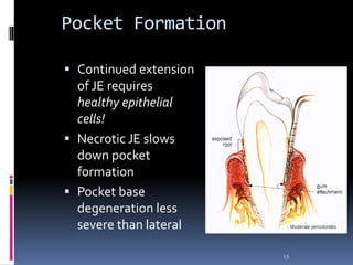 Pocket Formation
 Continued extension
of JE requires
healthy epithelial
cells!
 Necrotic JE slows
down pocket
formation
 Pocket base
degeneration less
severe than lateral
15
 