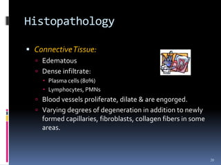 Histopathology
 ConnectiveTissue:
 Edematous
 Dense infiltrate:
 Plasma cells (80%)
 Lymphocytes, PMNs
 Blood vessels proliferate, dilate & are engorged.
 Varying degrees of degeneration in addition to newly
formed capillaries, fibroblasts, collagen fibers in some
areas.
20
 