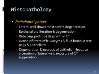 Histopathology
 Periodontal pocket:
 Lateral wall shows most severe degeneration
 Epithelial proliferation & degeneration
 Rete pegs protrude deep within CT
 Dense infiltrate of leukocytes & fluid found in rete
pegs & epithelium
 Degeneration & necrosis of epithelium leads to
ulceration of lateral wall, exposure of CT,
suppuration
21
 
