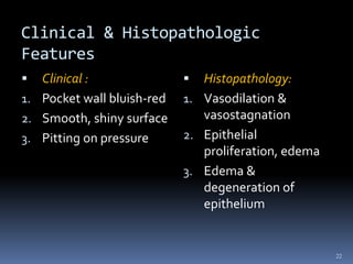 Clinical & Histopathologic
Features
 Clinical :
1. Pocket wall bluish-red
2. Smooth, shiny surface
3. Pitting on pressure
 Histopathology:
1. Vasodilation &
vasostagnation
2. Epithelial
proliferation, edema
3. Edema &
degeneration of
epithelium
22
 