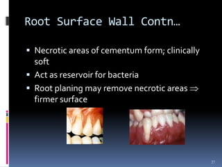 Root Surface Wall Contn…
 Necrotic areas of cementum form; clinically
soft
 Act as reservoir for bacteria
 Root planing may remove necrotic areas 
firmer surface
27
 