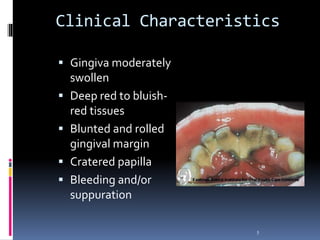 Clinical Characteristics
 Gingiva moderately
swollen
 Deep red to bluish-
red tissues
 Blunted and rolled
gingival margin
 Cratered papilla
 Bleeding and/or
suppuration
5
 