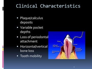 Clinical Characteristics
 Plaque/calculus
deposits
 Variable pocket
depths
 Loss of periodontal
attachment
 Horizontal/vertical
bone loss
 Tooth mobility
6
 