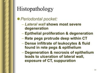 14
Histopathology
Periodontal pocket:
– Lateral wall shows most severe
degeneration
– Epithelial proliferation & degeneration
– Rete pegs protrude deep within CT
– Dense infiltrate of leukocytes & fluid
found in rete pegs & epithelium
– Degeneration & necrosis of epithelium
leads to ulceration of lateral wall,
exposure of CT, suppuration
 