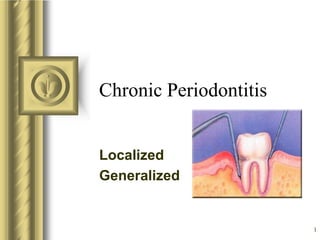 1
Chronic Periodontitis
Localized
Generalized
 