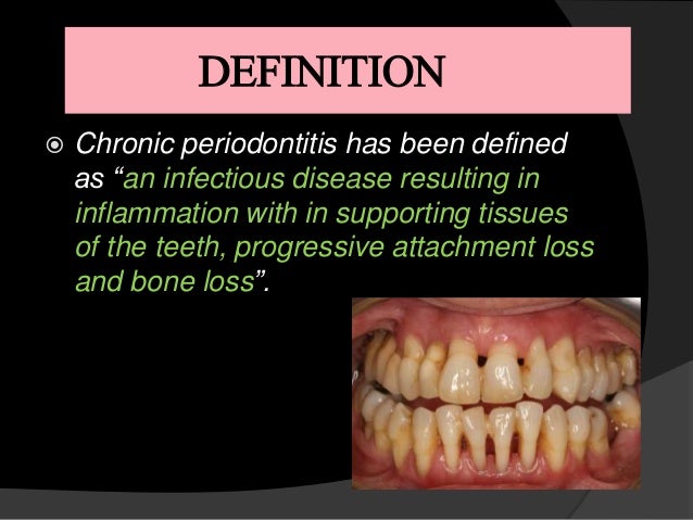 definition periodontal definition periodontal