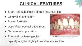 CLINICAL FEATURES
● Supra and subgingival plaque accumulation
● Gingival inflammation
● Pocket formation
● Loss of periodontal attachment
● Occasional suppuration
● Poor oral hygiene- gingiva
typically may be slightly to moderately swollen
 