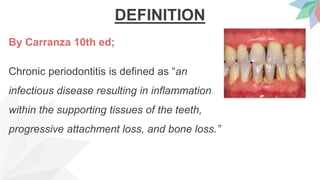 DEFINITION
By Carranza 10th ed;
Chronic periodontitis is defined as “an
infectious disease resulting in inflammation
within the supporting tissues of the teeth,
progressive attachment loss, and bone loss.”
 