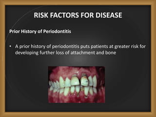 RISK FACTORS FOR DISEASE
Prior History of Periodontitis
• A prior history of periodontitis puts patients at greater risk for
developing further loss of attachment and bone
 