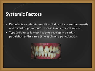 Systemic Factors
• Diabetes is a systemic condition that can increase the severity
and extent of periodontal disease in an affected patient.
• Type 2 diabetes is most likely to develop in an adult
population at the same time as chronic periodontitis.
 