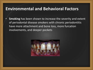 Environmental and Behavioral Factors
• Smoking has been shown to increase the severity and extent
of periodontal disease smokers with chronic periodontitis
have more attachment and bone loss, more furcation
involvements, and deeper pockets
 