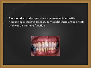 • Emotional stress has previously been associated with
necrotizing ulcerative disease, perhaps because of the effects
of stress on immune function
 
